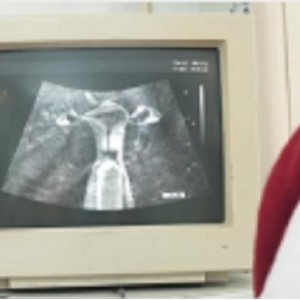 购买带老婆去医院做B超检查的B超仪，看到东西的CC神秘地带1V978M