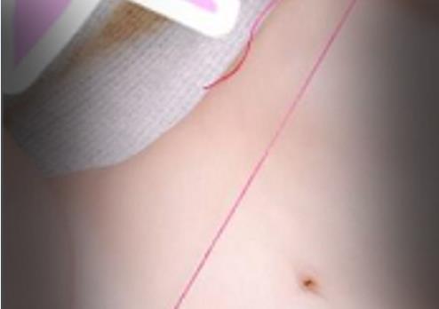 Myo-Via:功能退化的猎奇视图，适合女生和男人的头头教育师